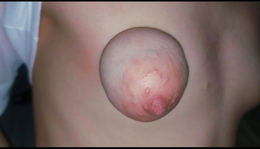 Stretching 18-year-old breasts